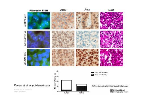 Neuroendocrine Tumors of the Pancreas