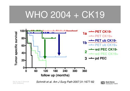 Neuroendocrine Tumors of the Pancreas