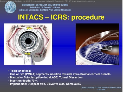 INTACS vs Cross-Linking for Keratoconus