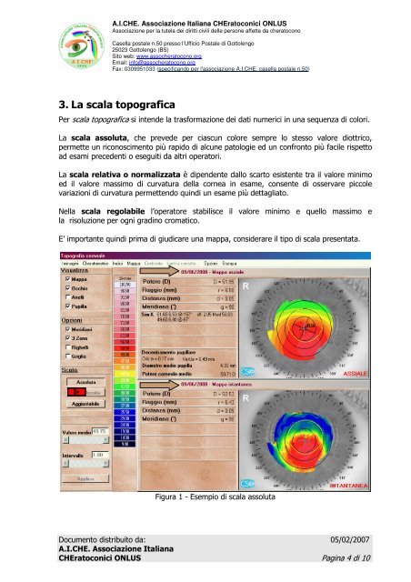 Guida alla lettura della Topografia Corneale