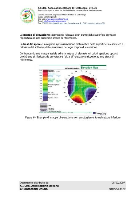 Guida alla lettura della Topografia Corneale