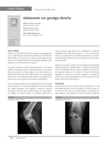 Adolescente con gonalgia derecha - AsociaciÃ³n Galega de ...