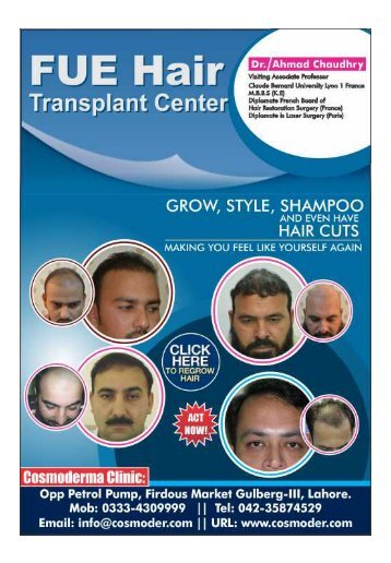 Hair transplant in Lahore 