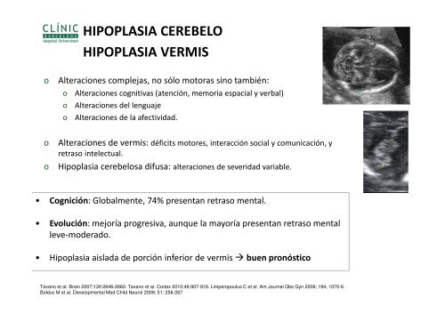 Normal - Medicina Fetal Barcelona