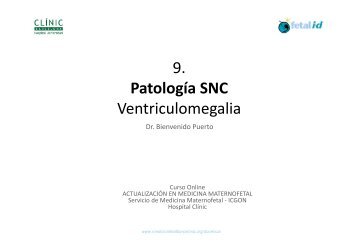 9 Patología SNC Ventriculomegalia