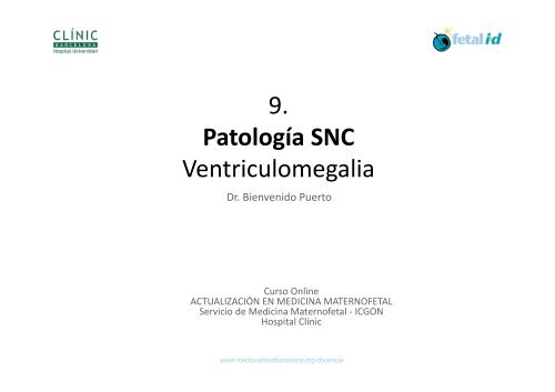 9 Patología SNC Ventriculomegalia