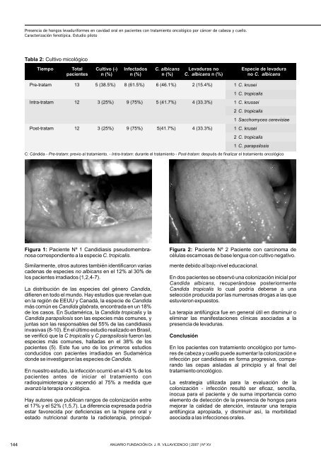 Presencia de hongos levaduriformes en cavidad oral en pacientes ...