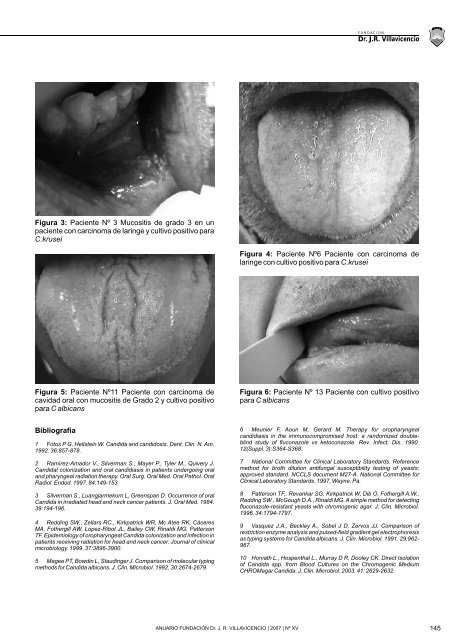 Presencia de hongos levaduriformes en cavidad oral en pacientes ...