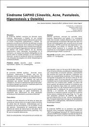 Sindrome SAPHO (Sinovitis Acne Pustulosis Hiperostosis y Osteitis)