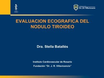 EVALUACION ECOGRAFICA DEL NODULO TIROIDEO