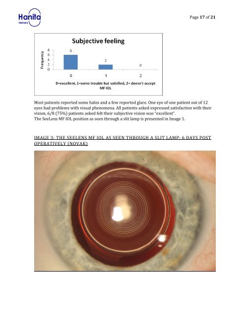SeeLens MF Intraocular Lens