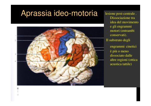 Teoria Neurocognitiva