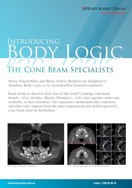 The Cone Beam specialists - Henry Schein Halas