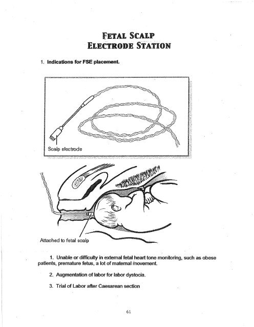 Fetal Scalp Electrode