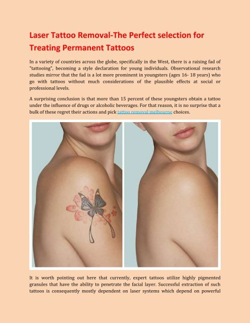 Laser Tattoo Removal-The Perfect selection for Treating Permanent Tattoos.pdf
