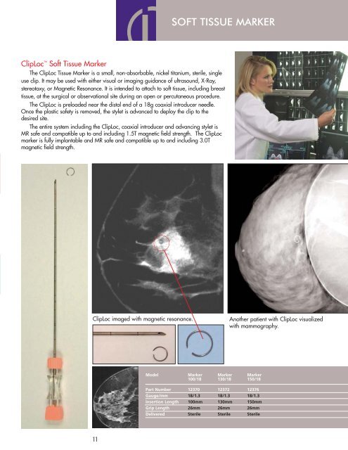 INTERVENTIONAL MRI