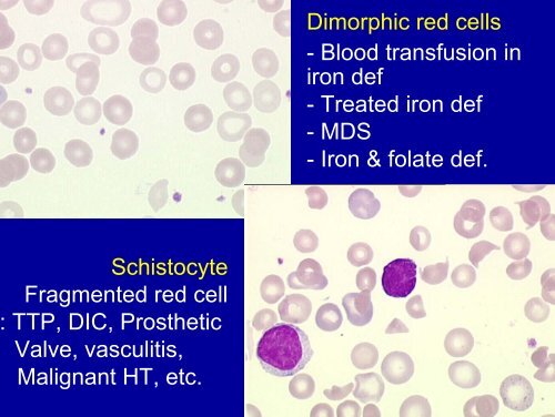 Blood smear