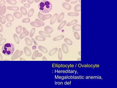 Blood smear