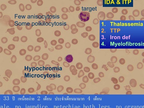 Blood smear