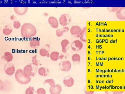 Blood smear