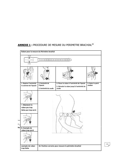 PROTOCOLE NATIONAL DE PRISE EN CHARGE DE LA MALNUTRITION AIGUE