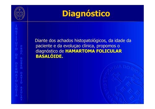 Polimorfismo clínico do hamartoma folicular basalóide