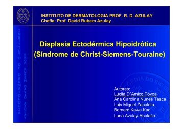 Displasia Ectodérmica Hipoidrótica (Síndrome de Christ-Siemens-Touraine)