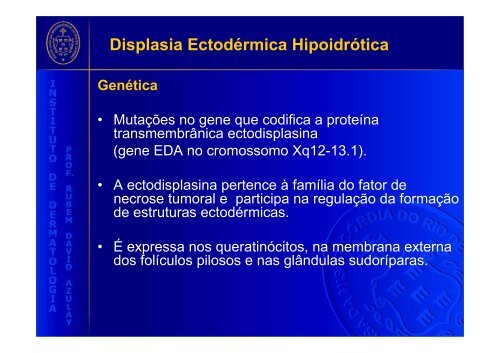 Displasia Ectodérmica Hipoidrótica (Síndrome de Christ-Siemens-Touraine)