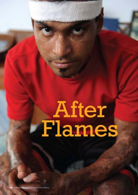 After Flames