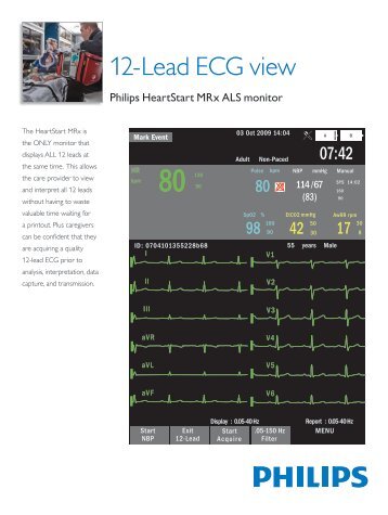 12-Lead ECG view - pgpic.com