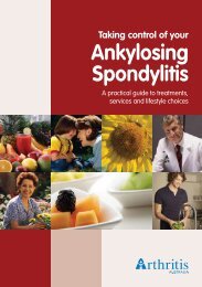 Ankylosing Spondylitis