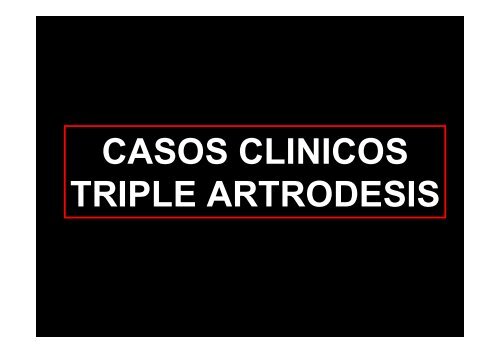 DOBLE Y TRIPLE ARTRODESIS