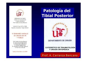 Patología del Tibial Posterior