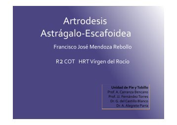 Artrodesis Astrágalo-Escafoidea