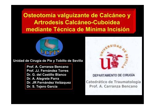 Artrodesis Calcáneo-Cuboidea mediante Técnica de Mínima Incisión