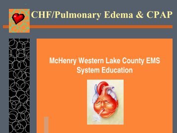 CHF/Pulmonary Edema & CPAP
