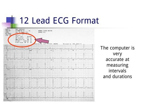 12 Expert-Approved Chili Sunlight Care Strategies - Featured Image
