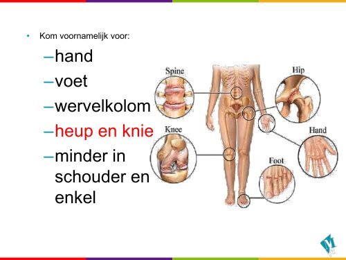 Artrose, behandeling en Rapid Recovery. - Martini Ziekenhuis