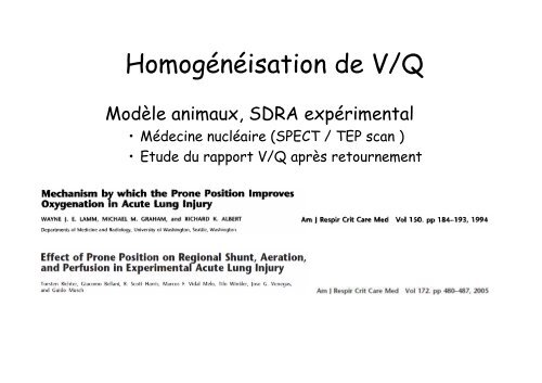 Physiologie du Décubitus Ventral dans le SDRA