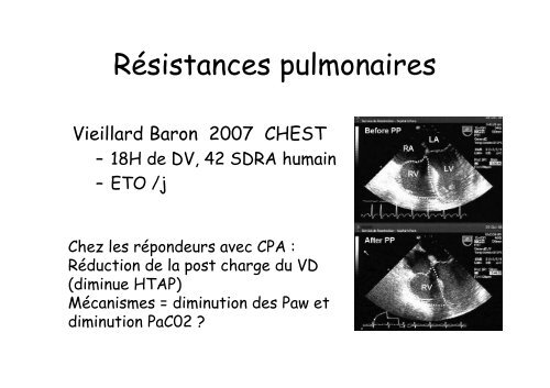 Physiologie du Décubitus Ventral dans le SDRA