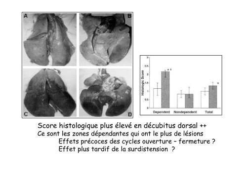 Physiologie du Décubitus Ventral dans le SDRA