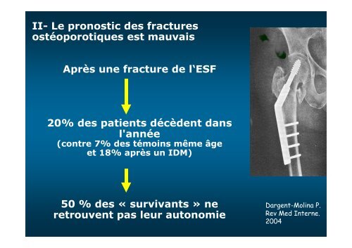 La Densitométrie est-elle toujours utile en 2012?