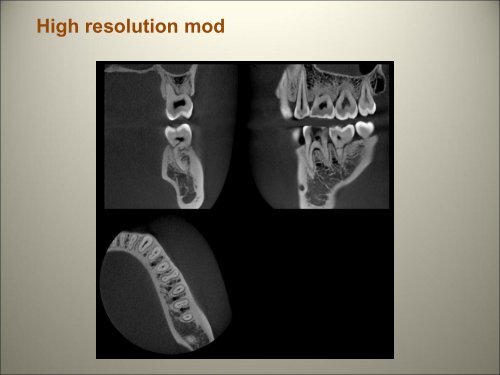 Morita 3D Accuitomo