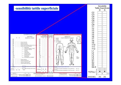 CLASSIFICAZIONE NEUROLOGICA STANDARD NEI TRAUMI MIDOLLARI