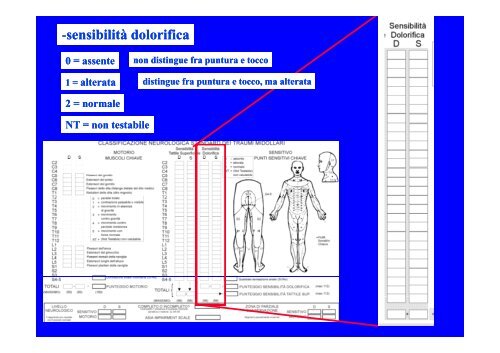 CLASSIFICAZIONE NEUROLOGICA STANDARD NEI TRAUMI MIDOLLARI