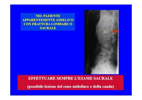 CLASSIFICAZIONE NEUROLOGICA STANDARD NEI TRAUMI MIDOLLARI