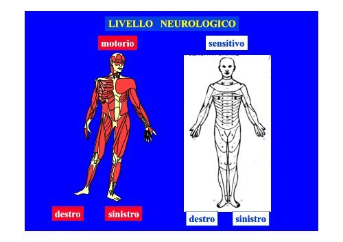 CLASSIFICAZIONE NEUROLOGICA STANDARD NEI TRAUMI MIDOLLARI