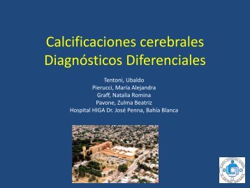 Calcificaciones cerebrales Diagnósticos Diferenciales