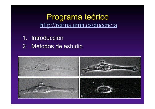 Página Web http://retina.umh.es/docencia