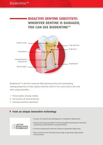 YOU CAN USE BIODENTINE